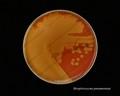 Streptococcus pneumoniae, alpha-hemolysis on blood agar, avirulent strain